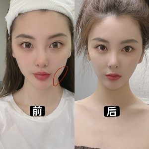 椰子理财电脑客户端椰子电脑一键端下载安装-第2张图片-太平洋在线下载